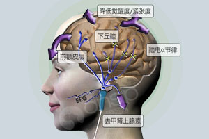 經顱磁刺激儀治療效果好不好