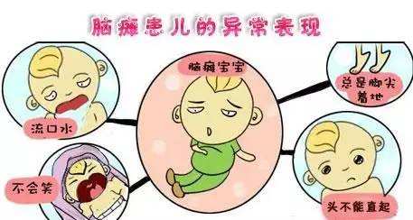 經(jīng)顱磁刺激儀治療腦癱效果怎么樣