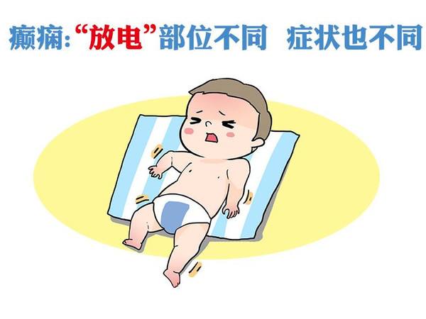 經顱磁刺激儀—治療小孩癲癇方法哪些效果好