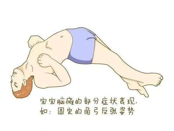 家長在照顧小兒腦癱患者時(shí)要怎么做效果好