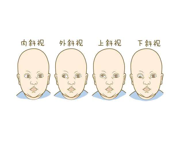 新生兒腦癱早期癥狀有哪些?新生兒腦癱的主要癥狀