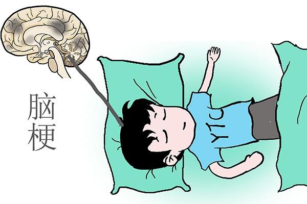 多功能經顱磁|輕微腦梗塞一般有哪些癥狀