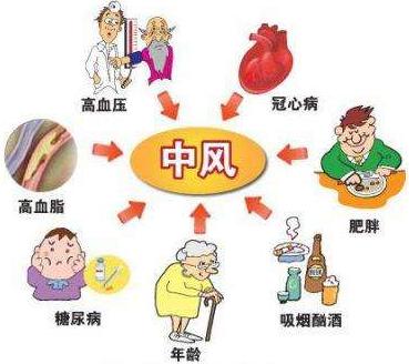 經(jīng)顱磁刺激治療儀|腦中風(fēng)發(fā)生前什么前兆