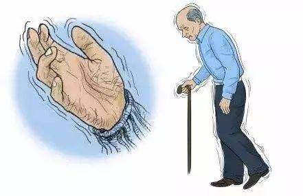 擇思達斯_帕金森病患者日?？祻妥⒁饽男?